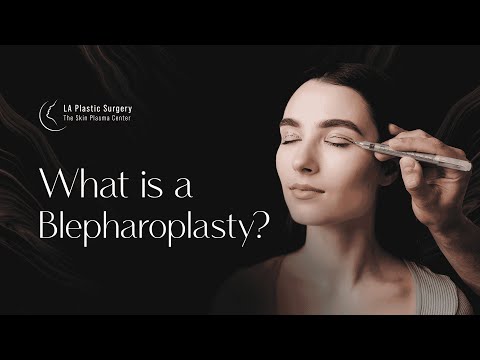 What is a Blepharoplasty? Eyelid Surgery Explained by Dr. Melinda Lacerna | LA PLASTIC