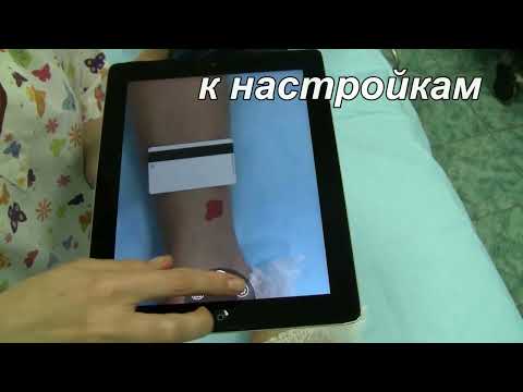 LesionMeter