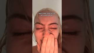 The Original Video of My Hair Falling Out… (part 1)  #hairfail #gonewrong #hair #bleaching