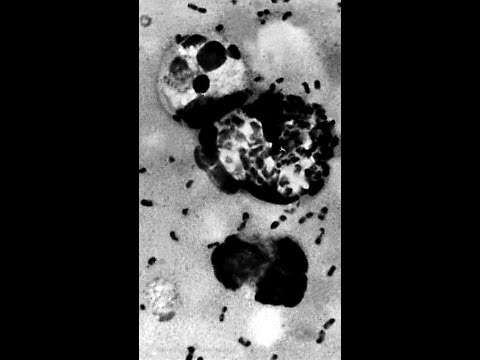 Are experts worried about a potential plague outbreak?
