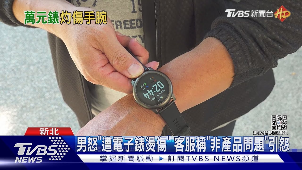 痛!電子錶「戴著睡」被燒傷 專家:恐電池釀禍