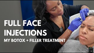 Botox and Fillers: Here's What Happened and What I Learned