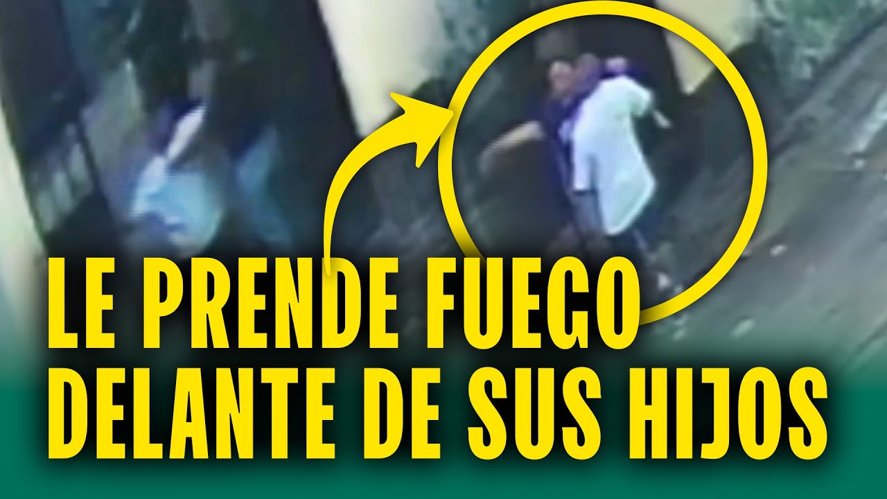 Le prende fuego a su pareja delante de sus hijos: Mujer termina en UCI tras ser cruelmente agredida