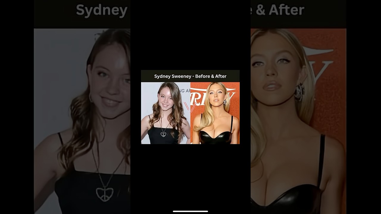 Sydney Sweeney full body surgery #euphoria #americaneagle #dojacat #models