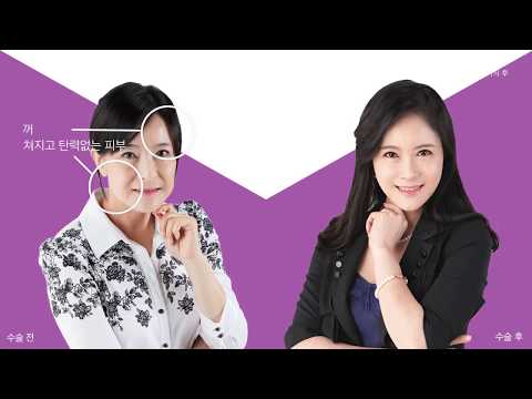 50대 주름성형후 인터뷰 영상 2편