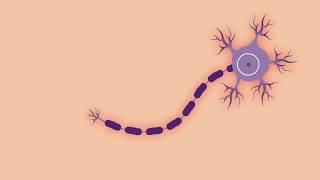 Animatie ‘Wat is MS?’