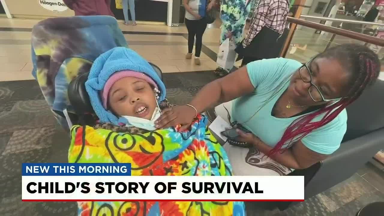 Upstate girl survives Shaken Baby syndrome