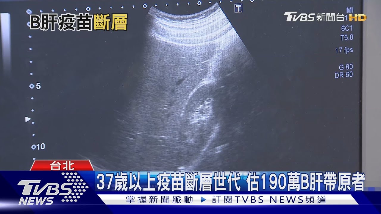不只國病更是沉默殺手！每30秒1人死於肝炎疾病　如何護好肝？