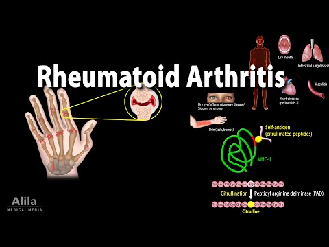 Overview of the Musculoskeletal System Animation
