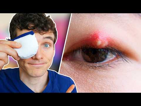How to Treat a Stye at Home & When to See a Doctor