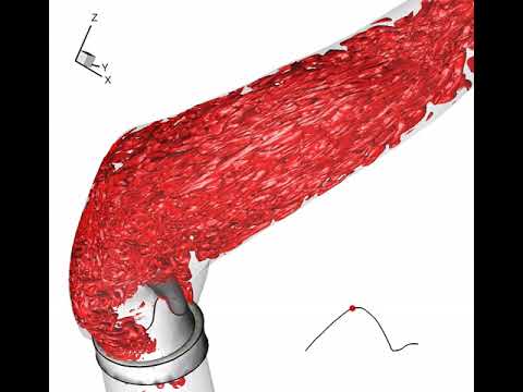 Bicuspid Aortic Valve Q-criterion