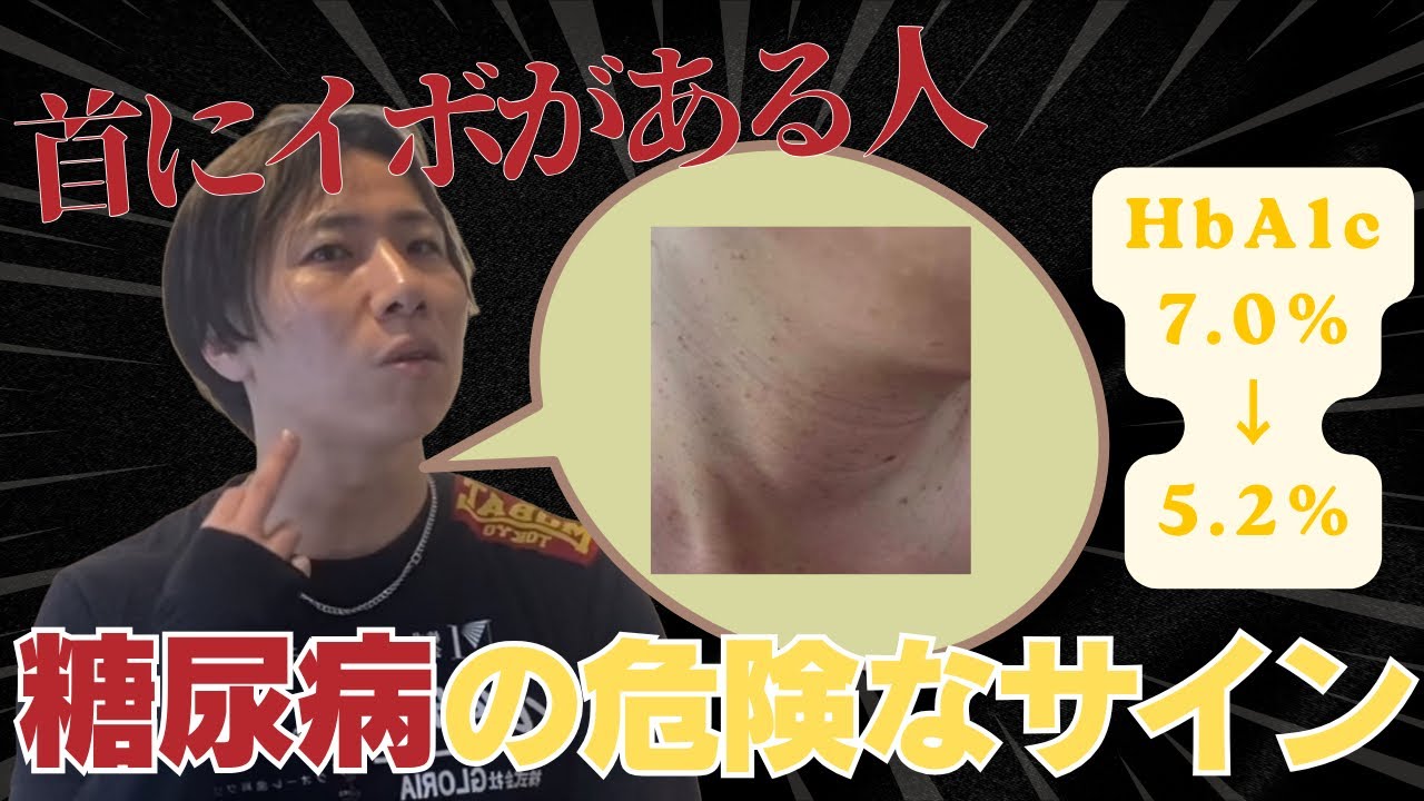 クビにイボは危険なサイン。血糖値がガチで下がるツボ