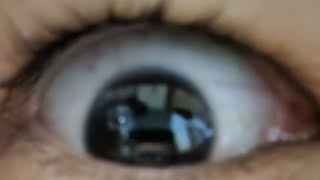 右目【バイオハザード リベレーションズ#1】