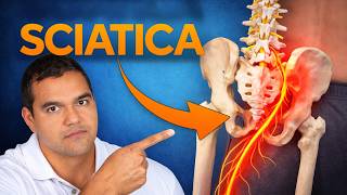 Understanding sciatica - Everything you need to know about the causes and treatment of sciatica