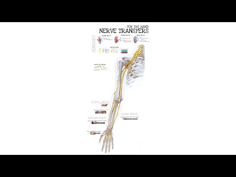 Sensory Nerve Transfers for Hand Function (Feat. Dr. Mackinnon)