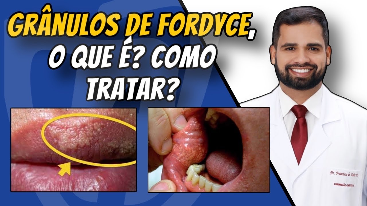 Francisco De Assis Almeida Lima Júnior-117