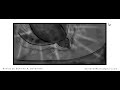 Happy Feet Seal Chase Scene Storyboard