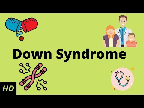 Down Syndrome, Causes, Signs and Symptoms, Diagnosis and Treatment.