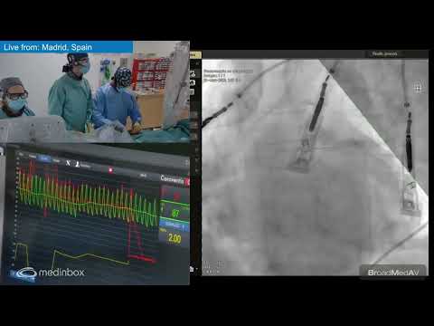 Coronary Microvascular Function with Regadenoson + Provocative Coronary Vasospasm Test