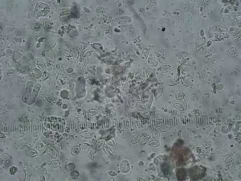 Histomonas in pheasant