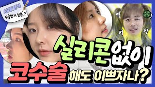 무보형물 코수술 전후 후기 무보정 영상