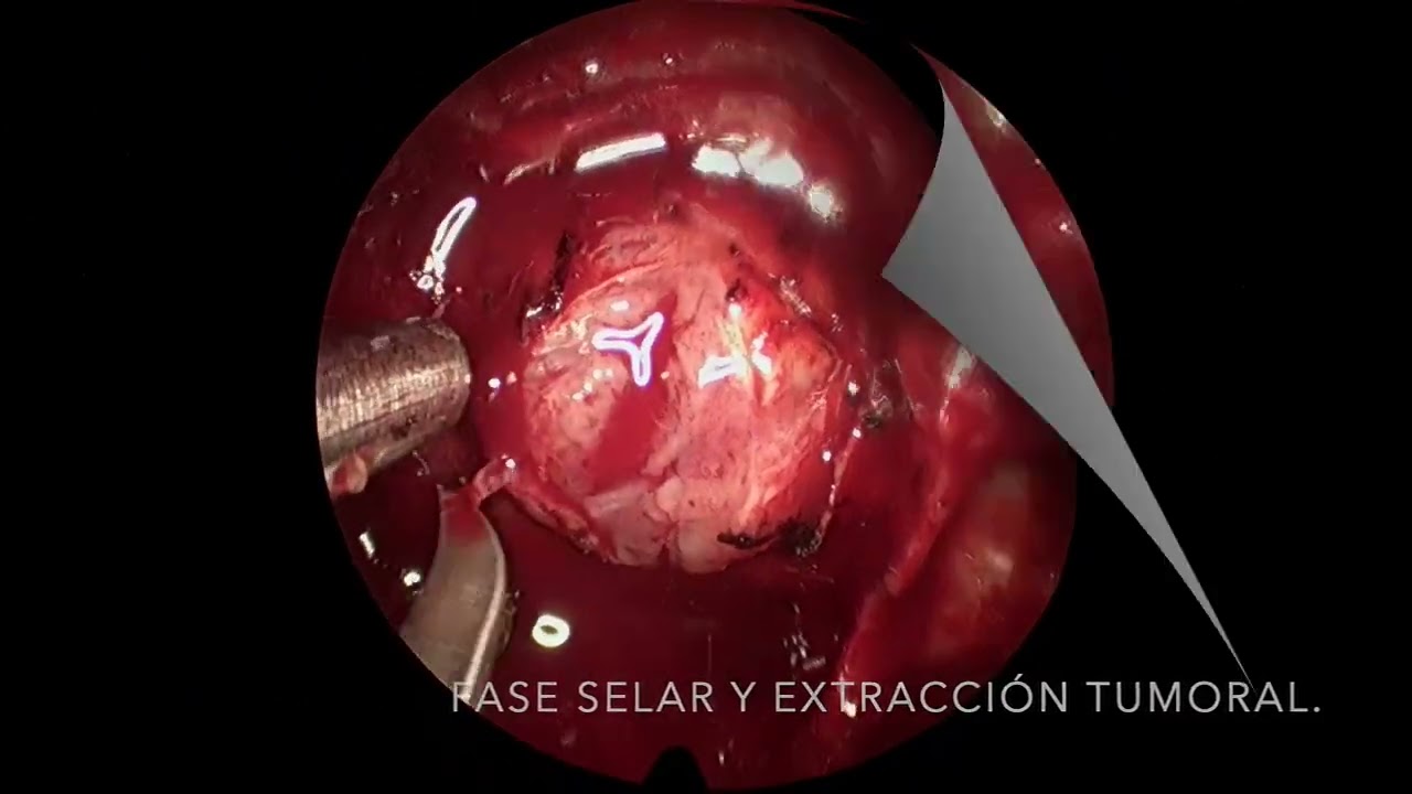 Alejandro Coronado-5