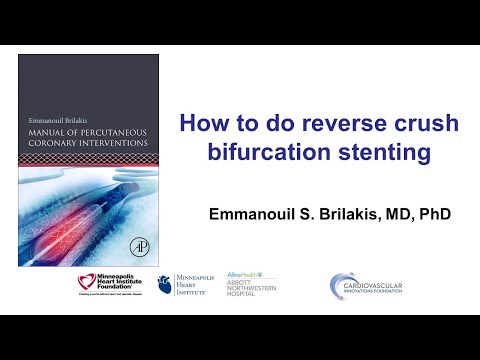 How to perform the reverse crush technique for bifurcation stenting