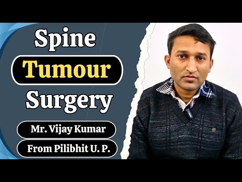 Spine Tumour surgery
