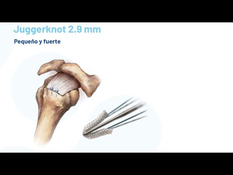 Juggerknot 2.9mm