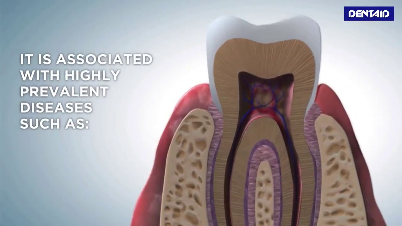 Can mouthwash remove biofilm? Tipseri