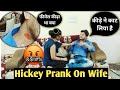 Hickey Prank On Wife Prank On Wife Love Bite Prank On Wife Prank On Wife In India Hickey Prank India
