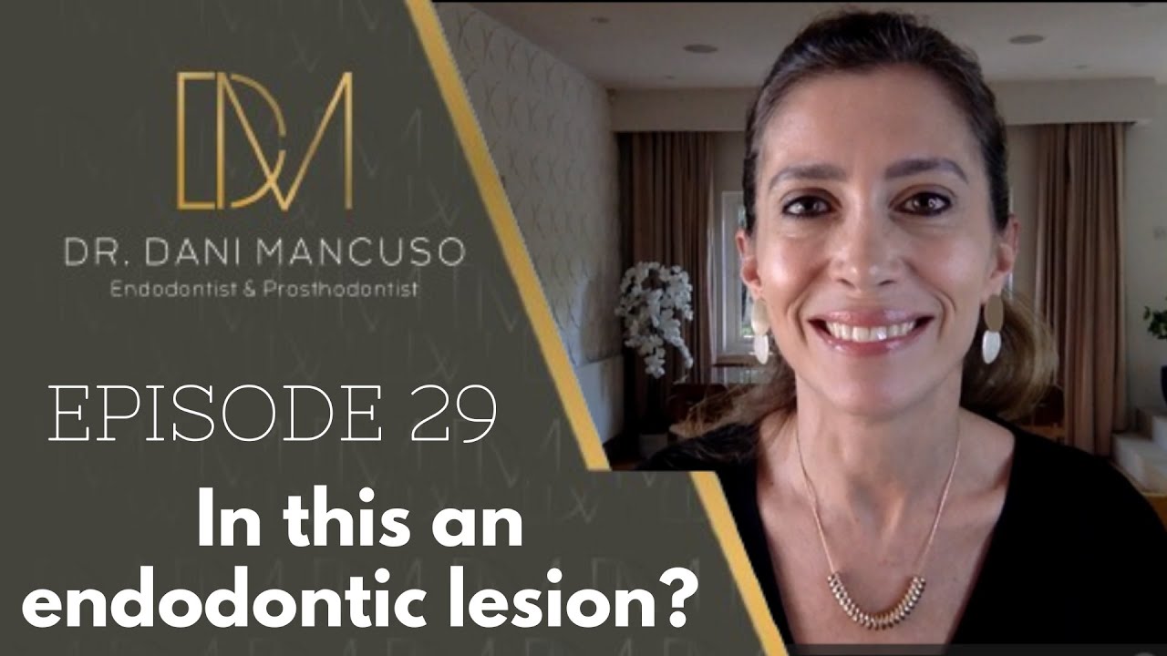 The Diary of an Endodontist - Episode 29 – In this an endodontic lesion?