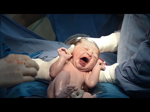 Meu Parto | Nascimento da Laura