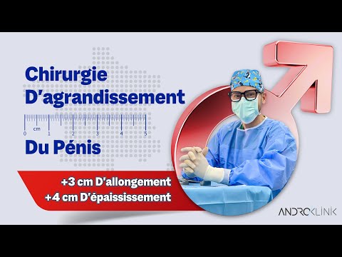 Chirurgie d'agrandissement du pénis (+3 cm d'allongement, +4 cm d'épaississement) - Dr. Evren ISIK