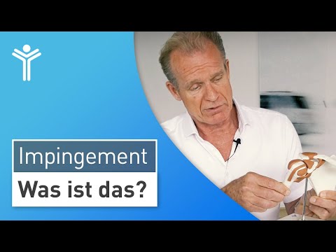 Impingement syndrome simply explained: The most common cause of shoulder pain!