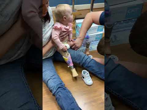 Getting fit with her prosthesis #viral #short #shortvideo #shorts #video #viralvideo #reels #fyp