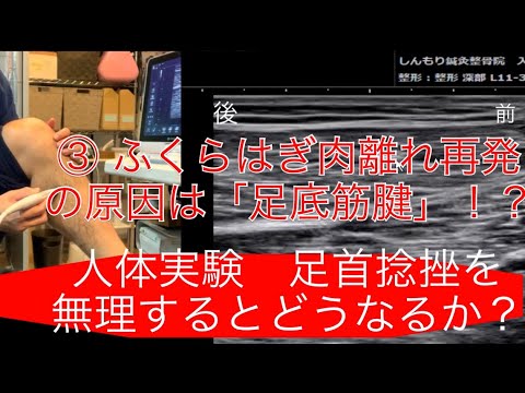 【人体実験③】ふくらはぎ肉離れエコー　足底筋腱