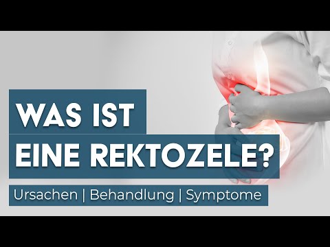 Was ist eine Rektozele? Dr. Eduard Karsten klärt auf