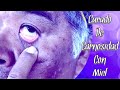 Miel Melipona CURA carnosidad de ojos
