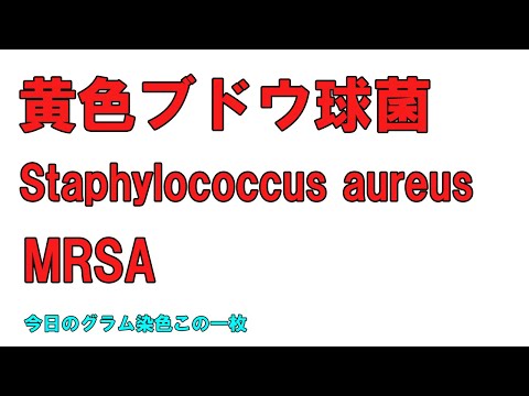 看護学科 今日のグラム染色この一枚 Staphylococcus aureus 黄色ブドウ球菌による菌血症