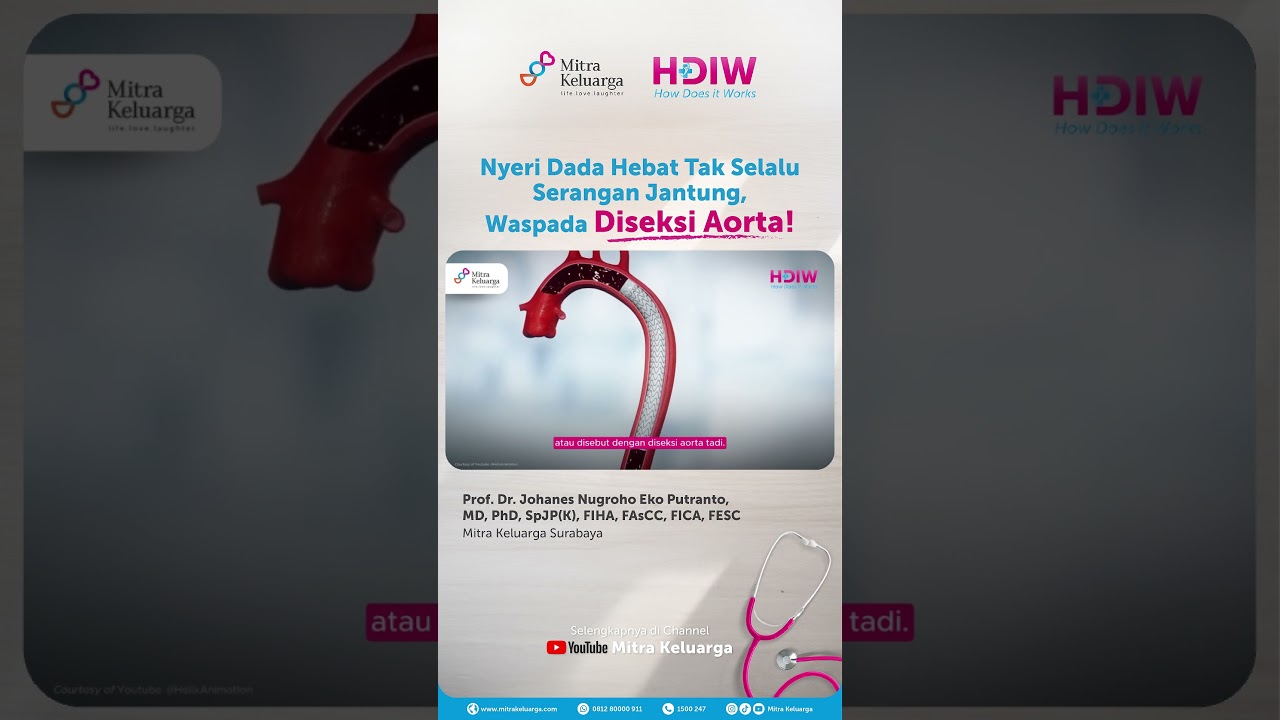 HDIW: Aortic Dissection Alert - Prof. Dr. J. Nugroho E. P., MD, PhD, SpJP(K), FIHA, FAsCC, FICA, ...