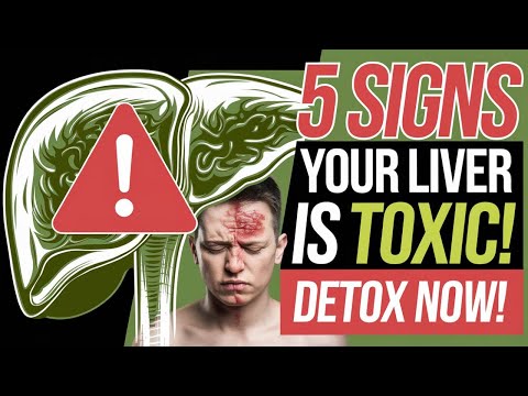 5 Warning Signs Your Liver is Full of Toxins & How to Detox It #health #healthtips