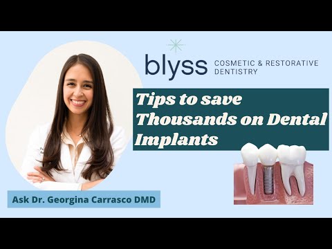 Dental Implant Cost in San Diego: Tips to Save Thousands on Dental Implants