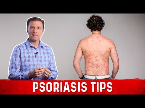 Bloody scalp psoriasis