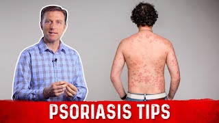 Get Rid of the Cause of Psoriasis Nutritionally