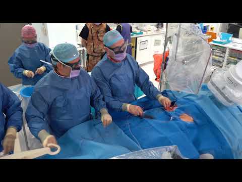 ABBOTT Portico Valve with FlexNav System Live in a Box