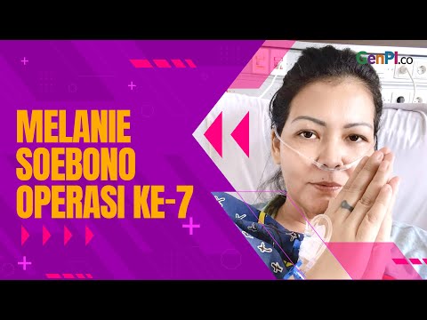 Kondisi Melanie Soebono Usai Operasi