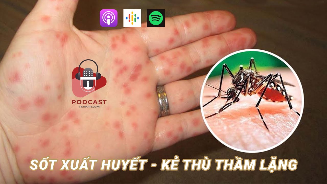 Cảnh giác với diễn biến của bệnh sốt xuất huyết trong mùa mưa