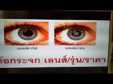 คลิกเพื่อดูคลิปวิดีโอ