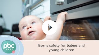 Burns safety for babies and young children